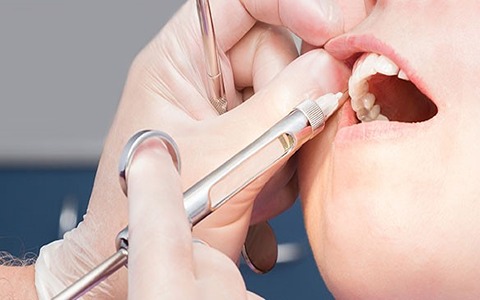 https://shp.aradbranding.com/خرید و فروش سرنگ تزریق دندانپزشکی بدون درد با شرایط فوق العاده