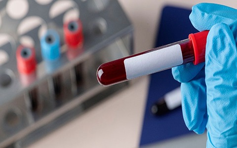 قیمت خرید لوله آزمایش لخته خون عمده به صرفه و ارزان