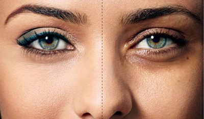 قیمت خرید كرم دور چشم + فروش ویژه