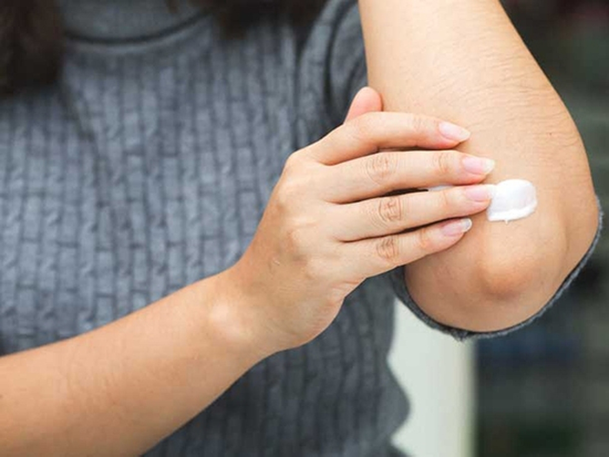 قیمت خرید کرم رفع تیرگی آرنج + فروش ویژه