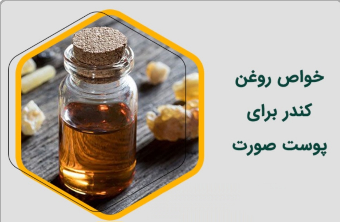 خرید روغن کندر لوکس و با کیفیت