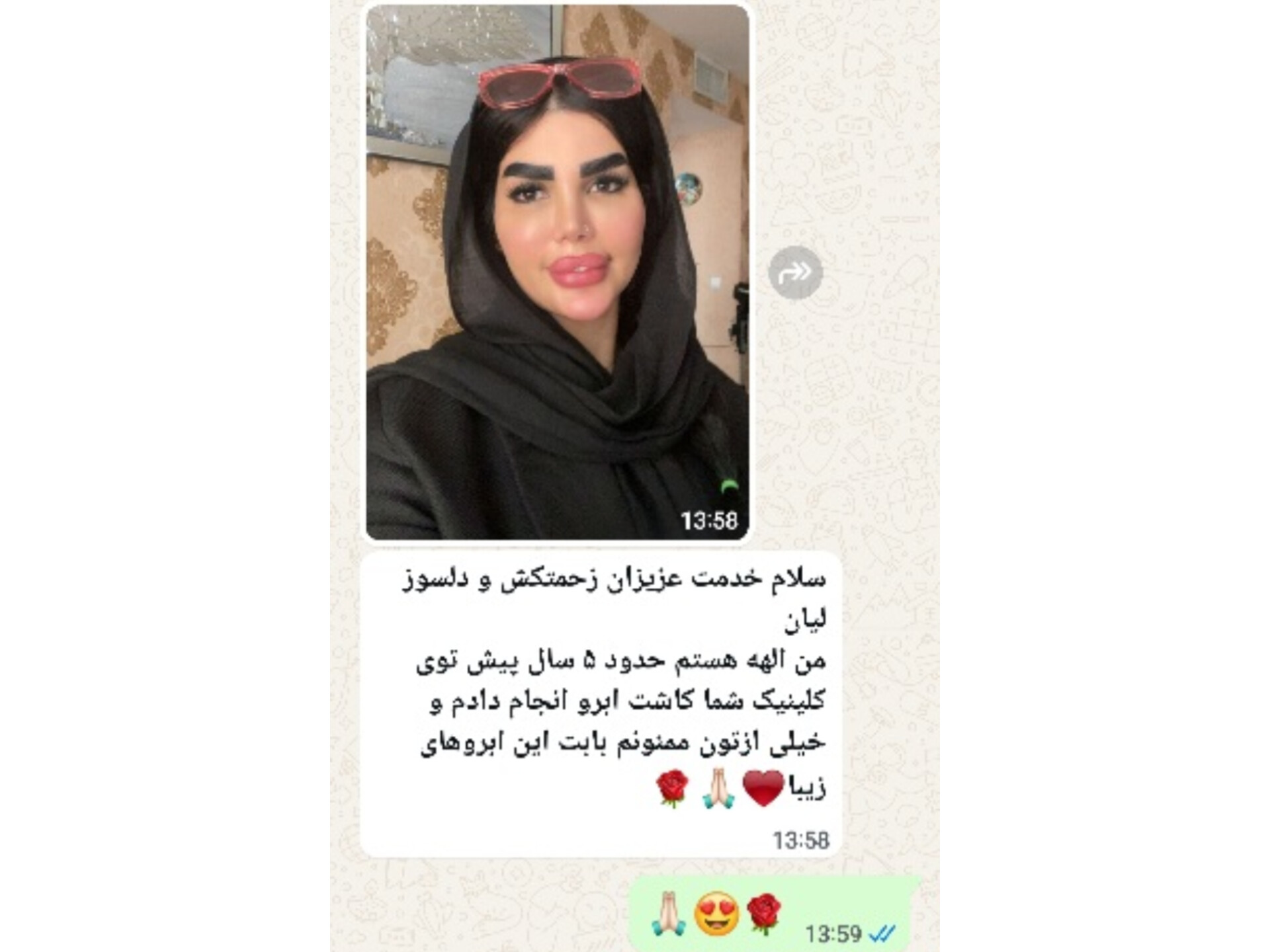 کاشت ابرو طبیعی با کیفیت و تراکم بالا