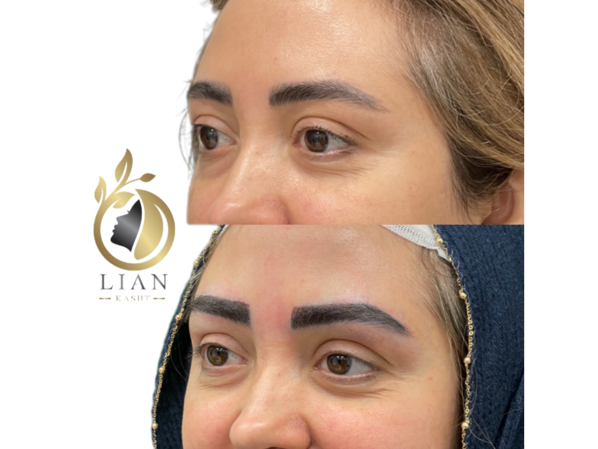 کاشت ابرو بدون جراحی(میکرو گرفت)