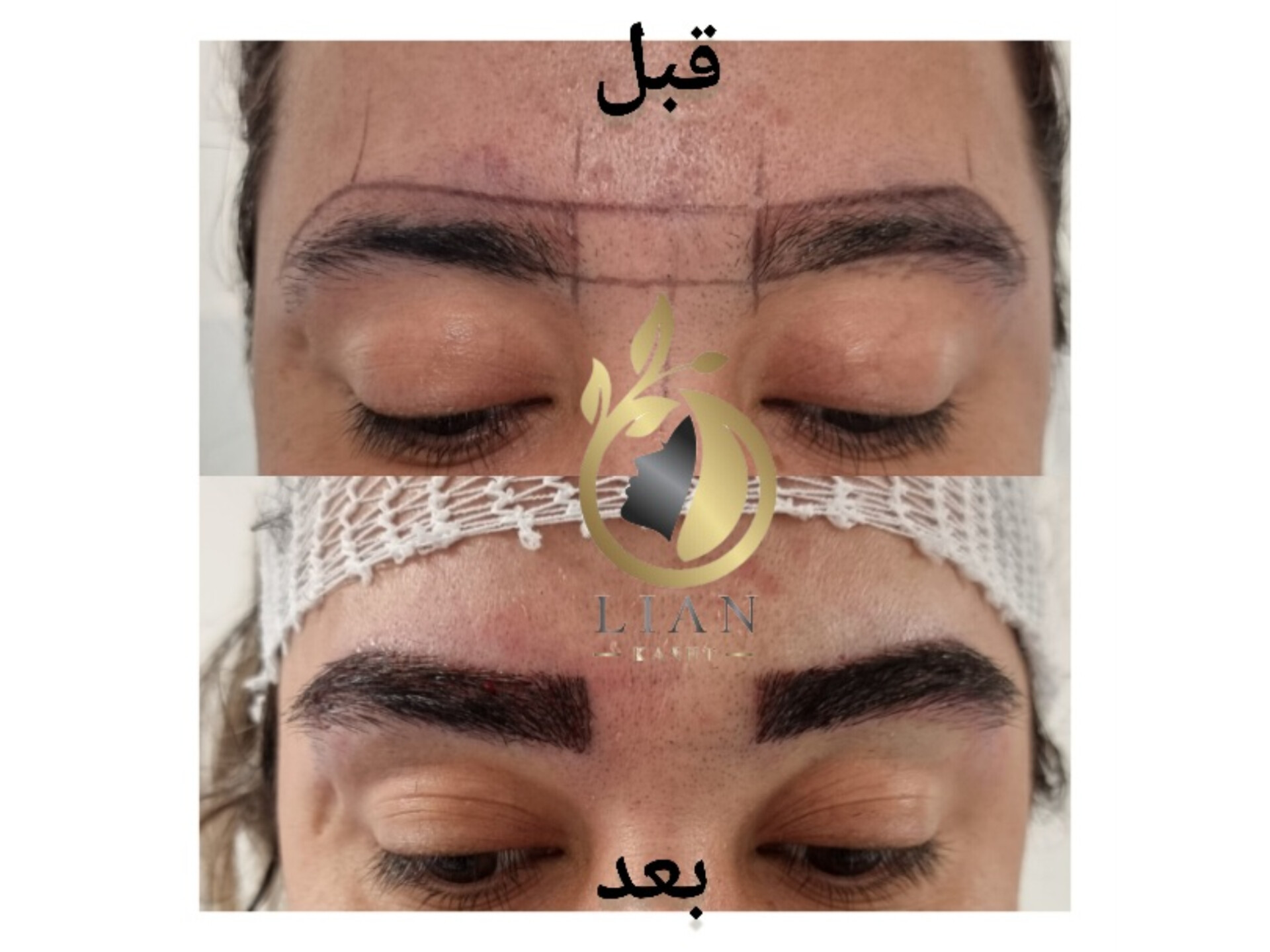 کاشت ابروی طبیعی با قیمت مناسب و ارزان
