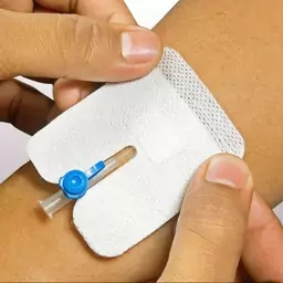 قیمت عمده چسب آنژیوکت