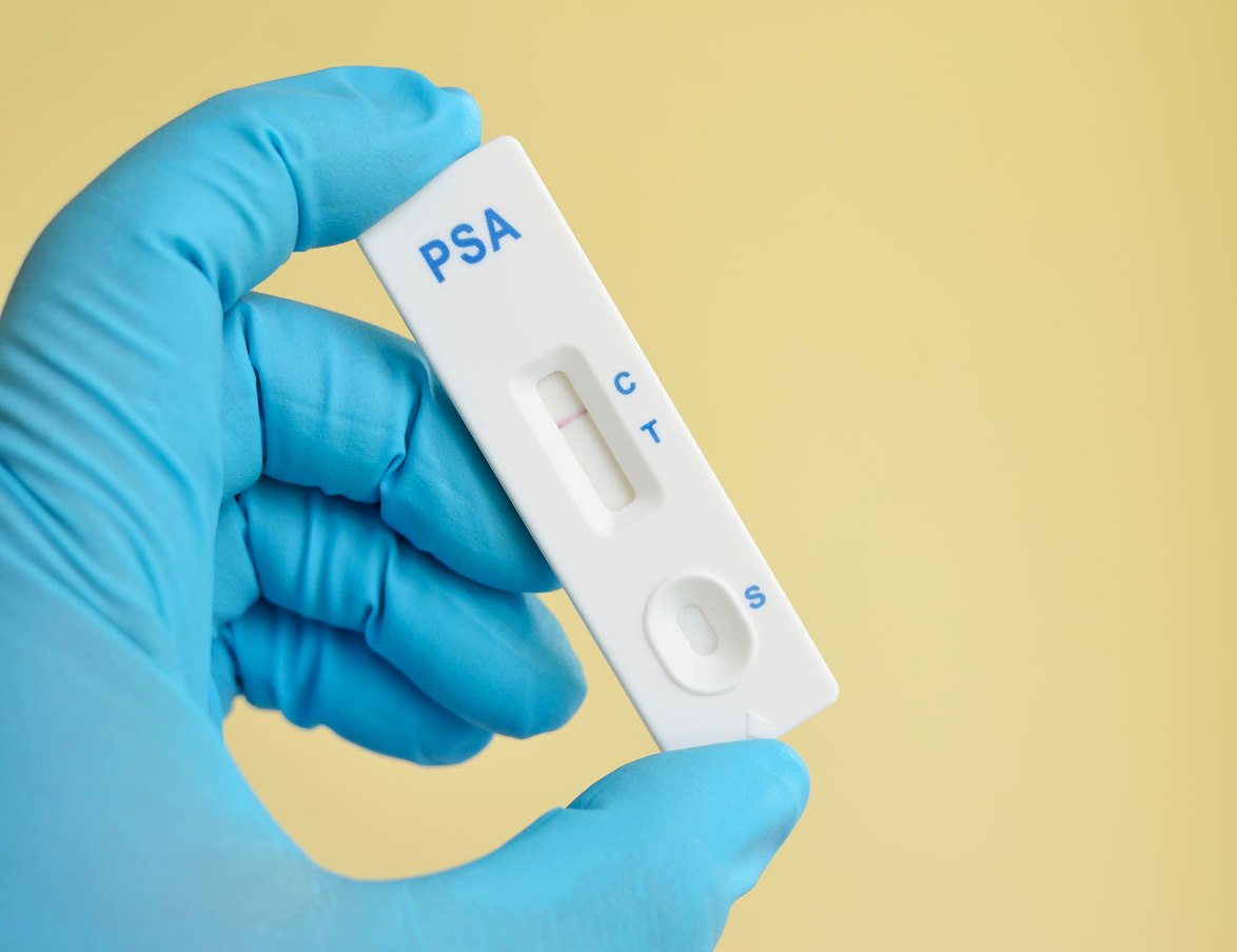فروش کیت تشخیص سریع psa سرطان پروستات، قیمت مناسب