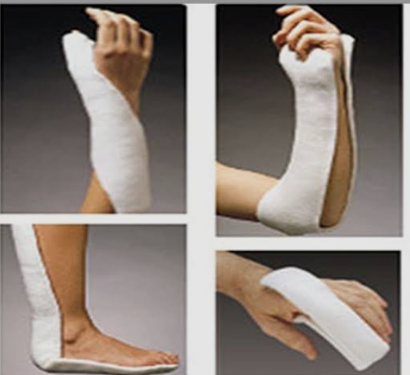 اتل گچی دست وپا + فروش عمده
