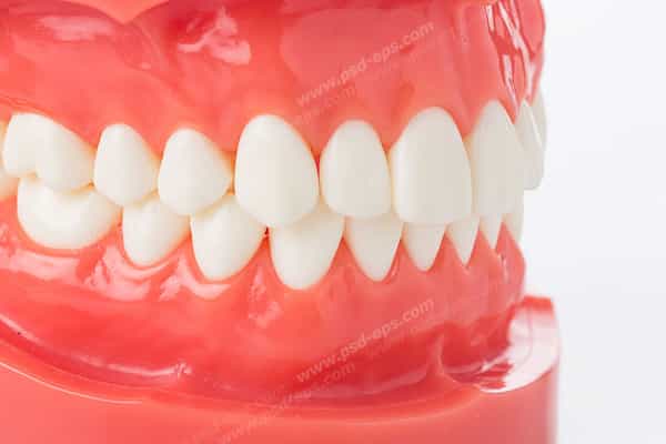 قیمت خرید دندان متحرک کامپوزیت + فروش ویژه