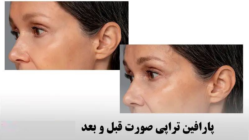خرید پارافین طبیعی پوست صورت و بدن با خدمات ویژه