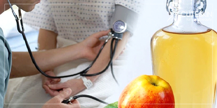 خرید سرکه سیب خالص + درمان فشار خون و چاقی