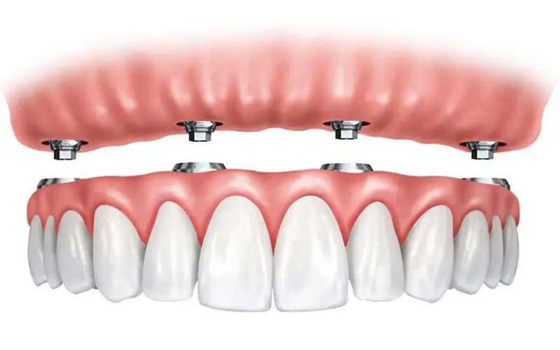 تصویر 4 از قیمت خرید تجهیزات دندان‌ پزشکی + فروش ویژه