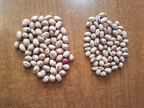 تصویر 1 از لوبیا چیتی بزرگ + دانه سالم و یک دست