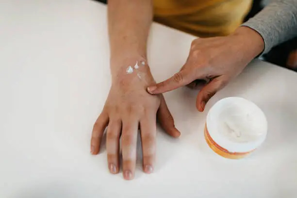 کرم پارگی پوست ترمیم زخم ‌های سطحی