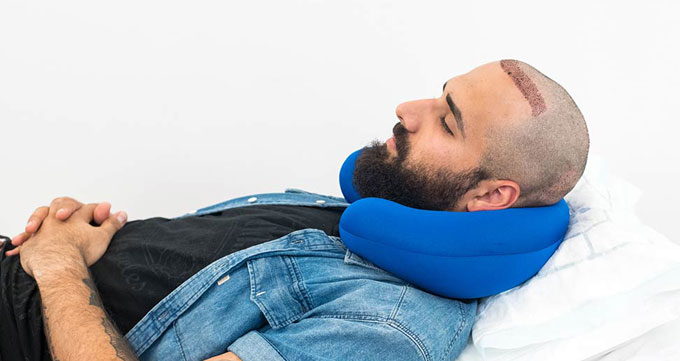 تصویر 4 از بالشت کاشت مو با کیفیت درجه یک برای استفاده روزانه