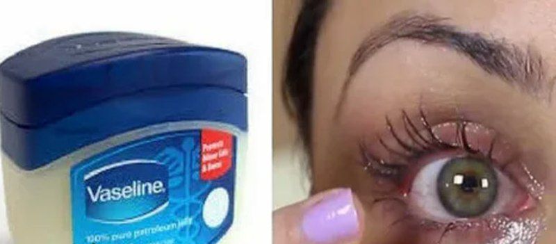 وازلین استریل چشمی معجزه‌ گر برای خشکی چشم