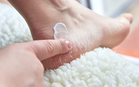 تصویر 5 از وازلین ترک پا درمان کننده خشکی و لبخند پاشنه