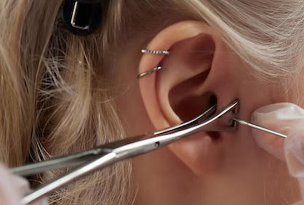 تصویر 2 از آنژیوکت برای گوش با نوک سوزن تیز کاهش درد اولیه تزریق