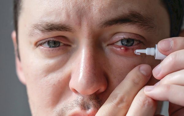 وازلین چشمی بهداشتی و سالم برای رطوبت دهی چشم