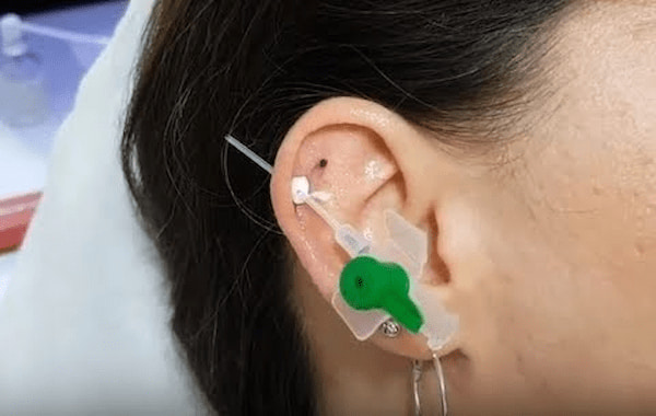 انواع آنژیوکت برای گوش با کیفیت و سایز بندی کامل