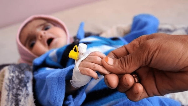 تصویر 1 از آنژیوکت اطفال حرفه ای پزشکی برای استفاده بیمارستانی