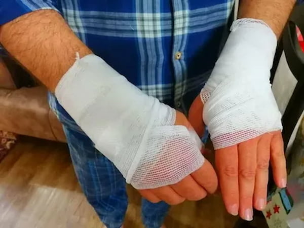 تصویر 1 از باند پانسمان ضد‌ حساسیت پزشکی درجه یک ممتاز