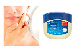 تصویر 3 از وازلین ضد قارچ با پالایش تقطیر چند مرحله‌ای