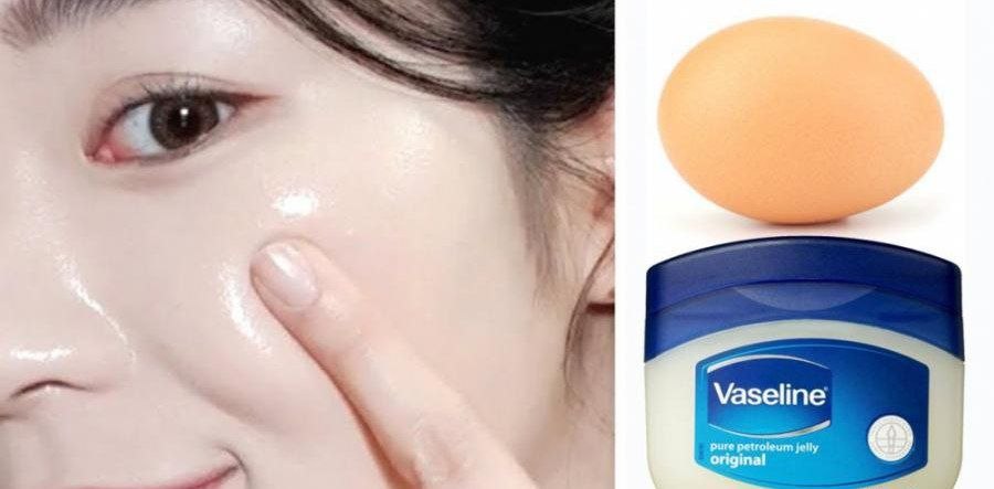 تصویر 3 از وازلین حاوی ویتامین ای مراقبت عمقی پوست خشک